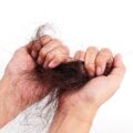hair loss problem women hands isolated white background